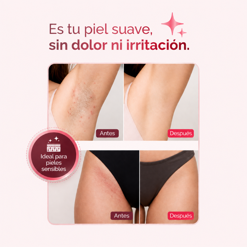 Depiladora eléctrica 4 en 1 – DermaFlex®