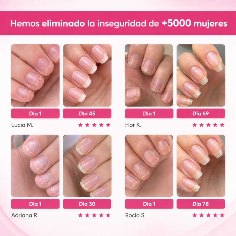 Tratamiento Fortalecedor y Reparador para Uñas Débiles – ReparaNail™