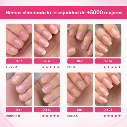 Tratamiento Fortalecedor y Reparador para Uñas Débiles – ReparaNail™