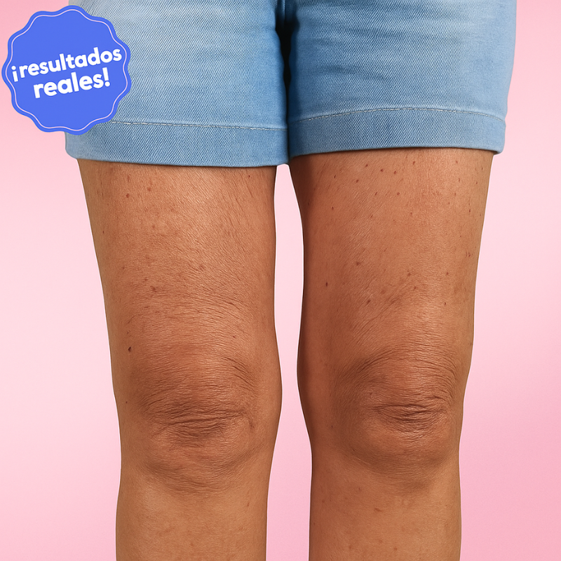 Cintas Liftee – Tu Piel Firme en Segundos