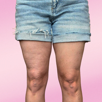 Cintas Liftee – Tu Piel Firme en Segundos