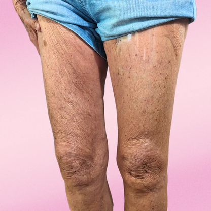 Cintas Liftee – Tu Piel Firme en Segundos